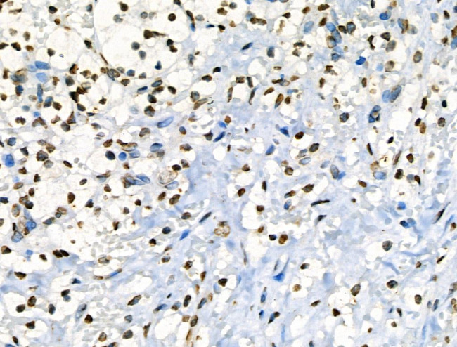 Phospho-JAK2 (Tyr1008) Antibody in Immunohistochemistry (Paraffin) (IHC (P))