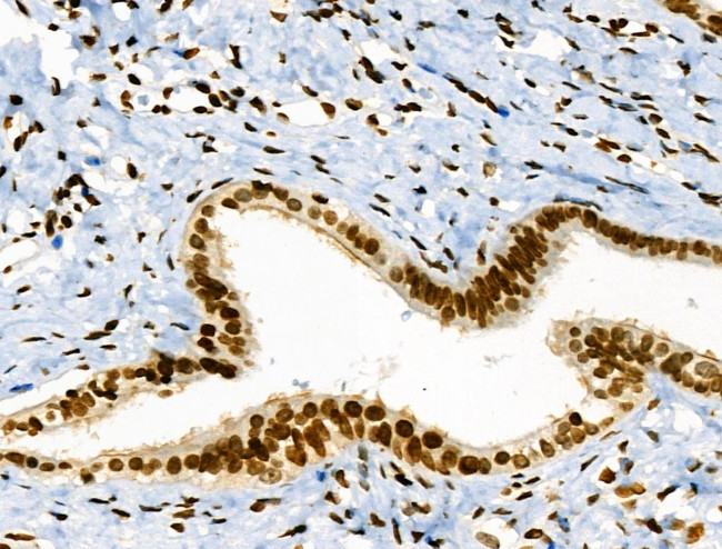 Phospho-JAK2 (Tyr1008) Antibody in Immunohistochemistry (Paraffin) (IHC (P))