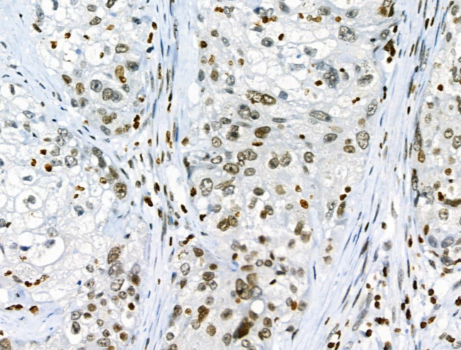 Phospho-JAK2 (Tyr1008) Antibody in Immunohistochemistry (Paraffin) (IHC (P))