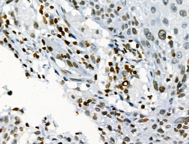 Phospho-JAK2 (Tyr1008) Antibody in Immunohistochemistry (Paraffin) (IHC (P))