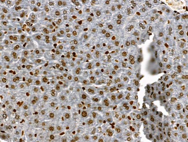 Phospho-JAK2 (Tyr1008) Antibody in Immunohistochemistry (Paraffin) (IHC (P))