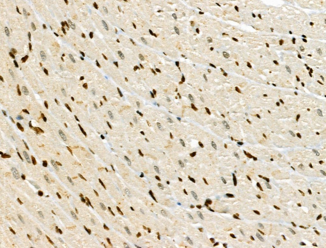 Phospho-JAK2 (Tyr1008) Antibody in Immunohistochemistry (Paraffin) (IHC (P))