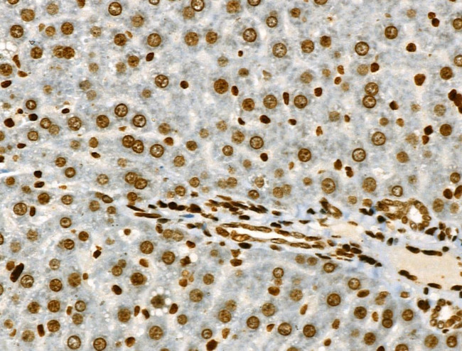 Phospho-JAK2 (Tyr1008) Antibody in Immunohistochemistry (Paraffin) (IHC (P))