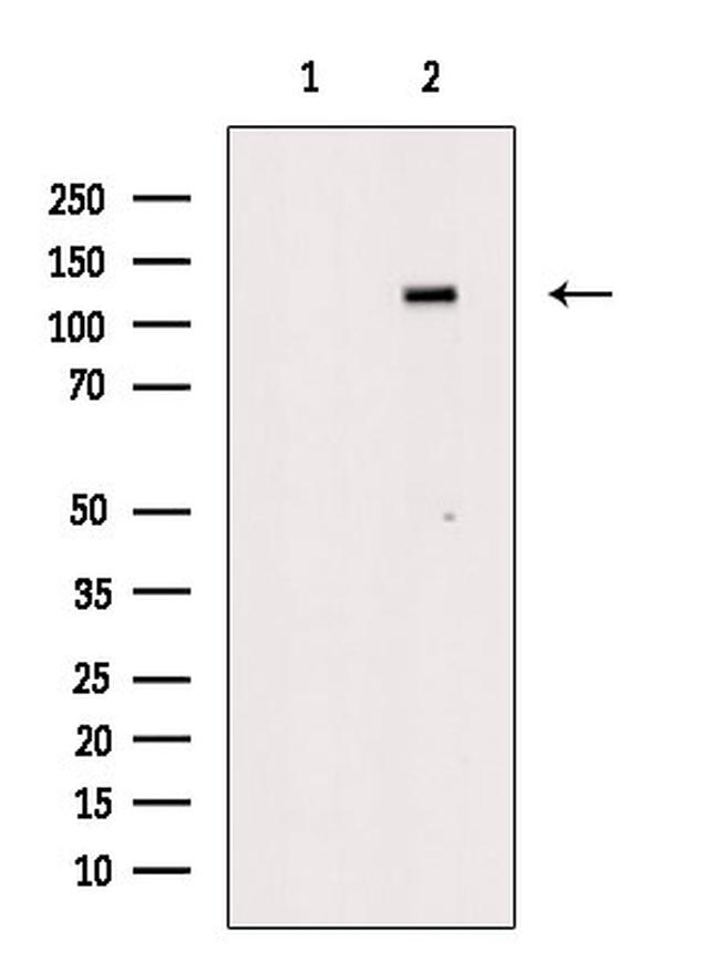 Phospho-JAK2 (Tyr1008) Antibody in Western Blot (WB)