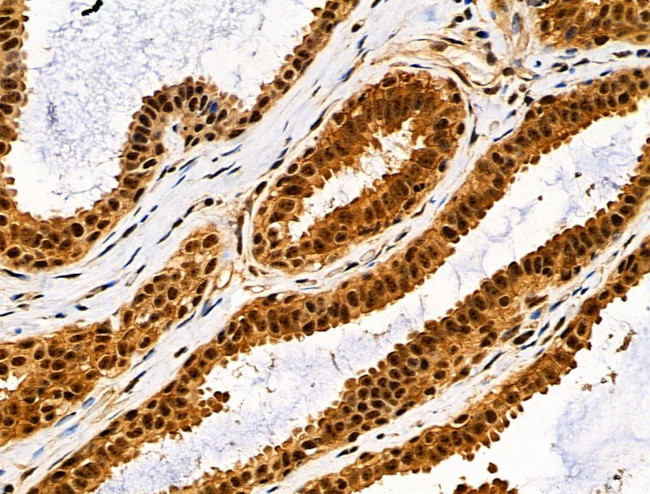 Phospho-JIP1 (Thr205) Antibody in Immunohistochemistry (Paraffin) (IHC (P))