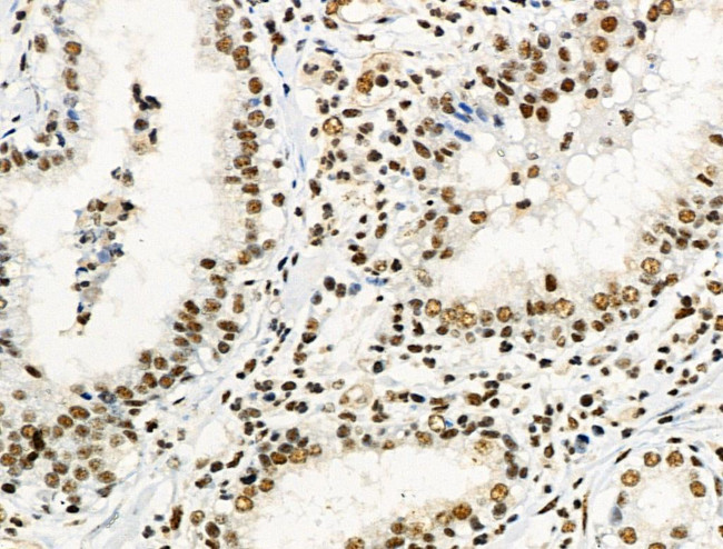 Phospho-JIP1 (Thr205) Antibody in Immunohistochemistry (Paraffin) (IHC (P))