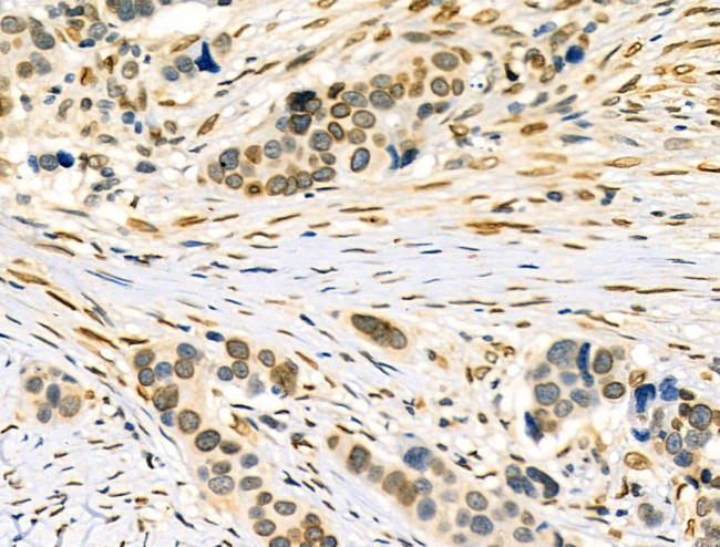 Phospho-Lamin A/C (Ser390) Antibody in Immunohistochemistry (Paraffin) (IHC (P))