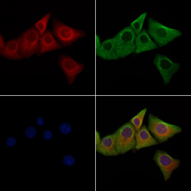 Phospho-LRRK2 (Ser910) Antibody in Immunocytochemistry (ICC/IF)