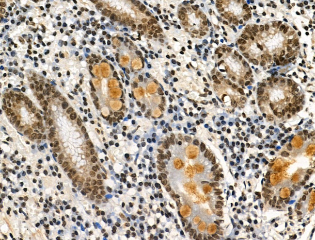 Phospho-LRRK2 (Ser910) Antibody in Immunohistochemistry (Paraffin) (IHC (P))