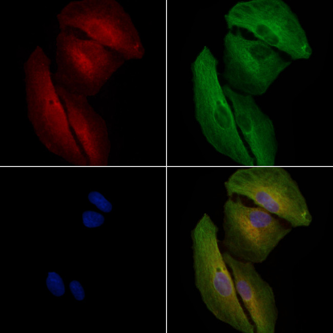 Phospho-LRRK2 (Ser935) Antibody in Immunocytochemistry (ICC/IF)