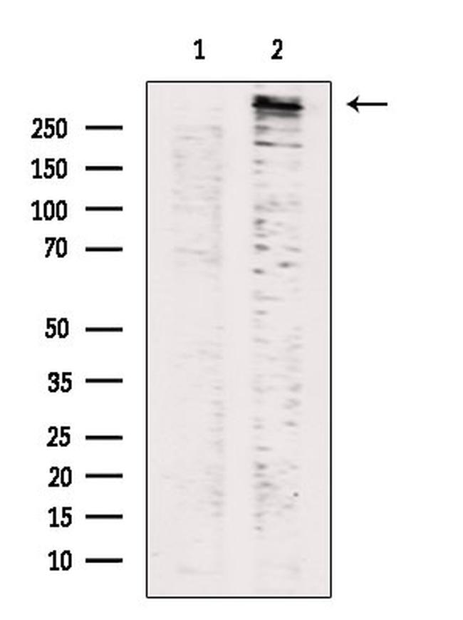 Phospho-LRRK2 (Ser935) Antibody in Western Blot (WB)