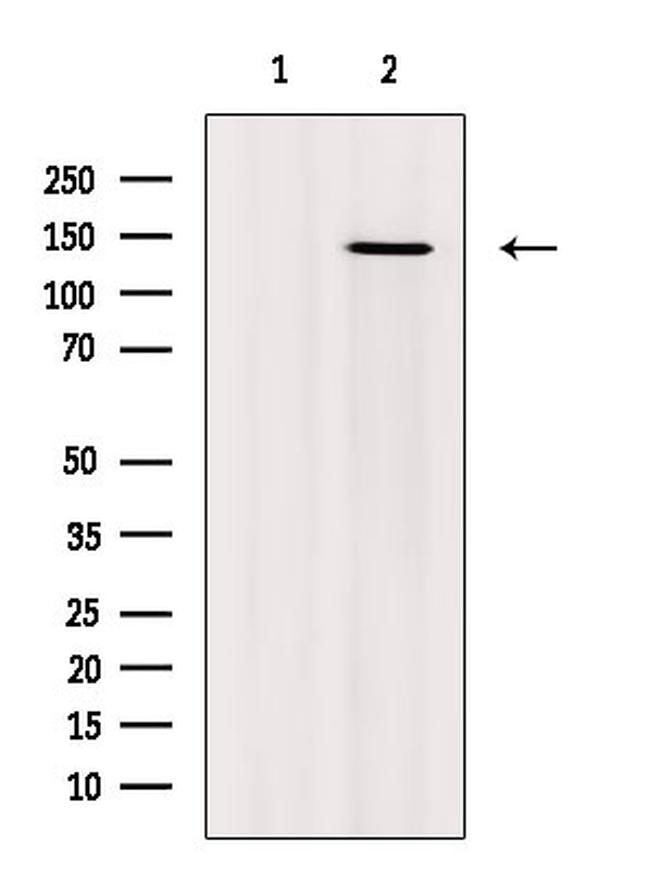 Phospho-NFATC2 (Ser53) Antibody in Western Blot (WB)