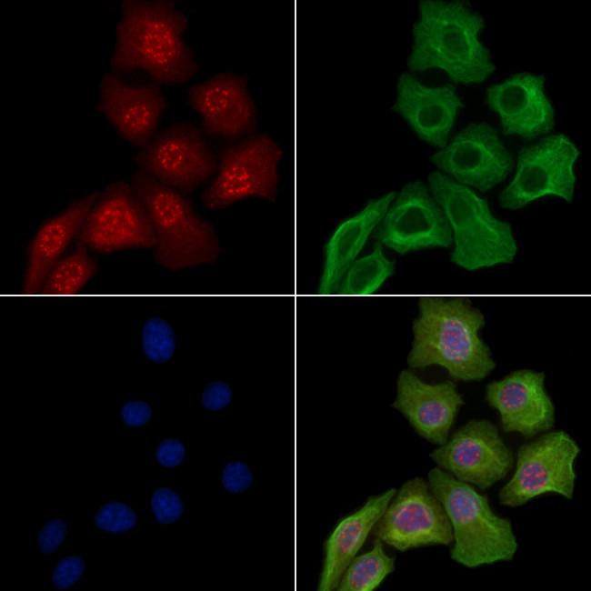 Phospho-NPM1 (Ser125) Antibody in Immunocytochemistry (ICC/IF)