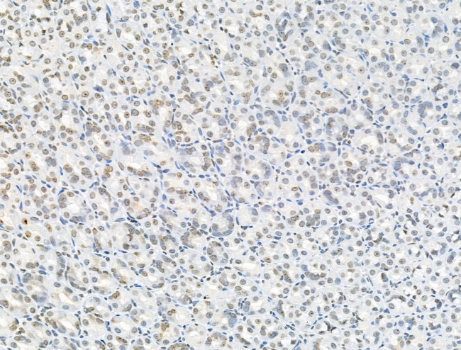 Phospho-NPM1 (Ser125) Antibody in Immunohistochemistry (Paraffin) (IHC (P))