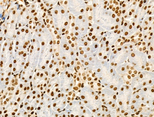 Phospho-NPM1 (Ser125) Antibody in Immunohistochemistry (Paraffin) (IHC (P))