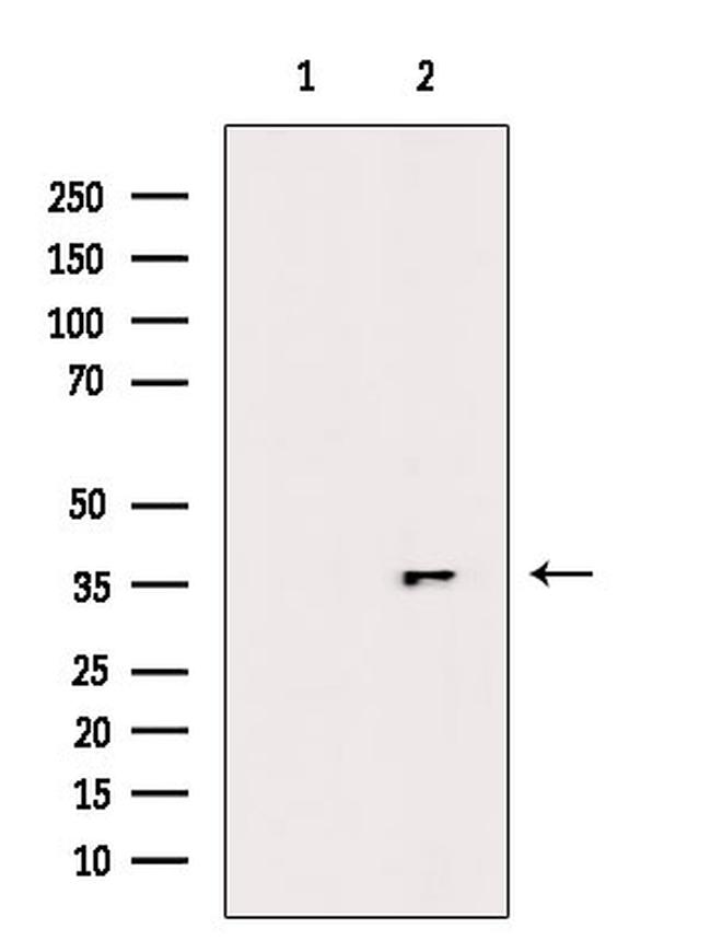 Phospho-NPM1 (Ser125) Antibody in Western Blot (WB)