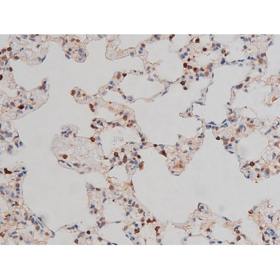 Phospho-p70 S6 Kinase (Thr252) Antibody in Immunohistochemistry (Paraffin) (IHC (P))