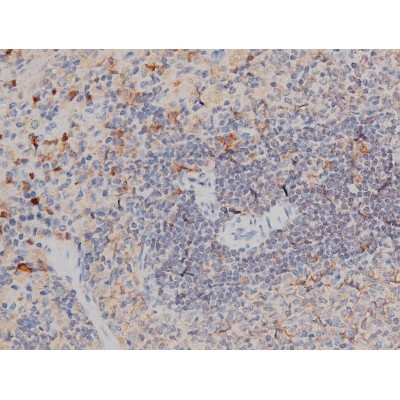 Phospho-p70 S6 Kinase (Thr252) Antibody in Immunohistochemistry (Paraffin) (IHC (P))