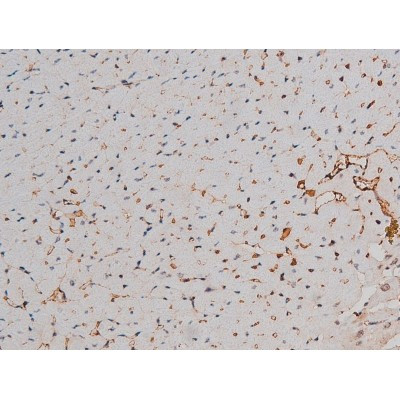 Phospho-p70 S6 Kinase (Thr252) Antibody in Immunohistochemistry (Paraffin) (IHC (P))