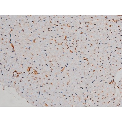 Phospho-p70 S6 Kinase (Thr252) Antibody in Immunohistochemistry (Paraffin) (IHC (P))