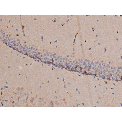 Phospho-p70 S6 Kinase (Thr252) Antibody in Immunohistochemistry (Paraffin) (IHC (P))