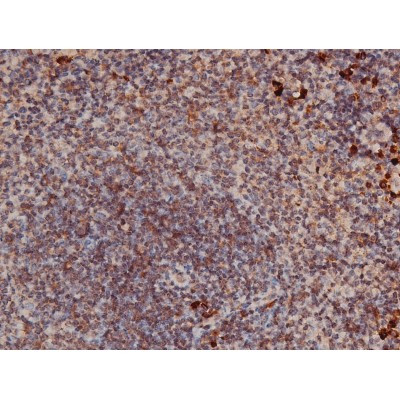 Phospho-p70 S6 Kinase (Thr252) Antibody in Immunohistochemistry (Paraffin) (IHC (P))