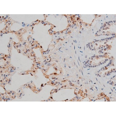 Phospho-p70 S6 Kinase (Thr252) Antibody in Immunohistochemistry (Paraffin) (IHC (P))