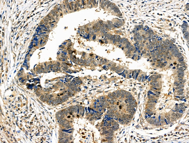 Phospho-PAK4/5/6 (Ser474) Antibody in Immunohistochemistry (Paraffin) (IHC (P))