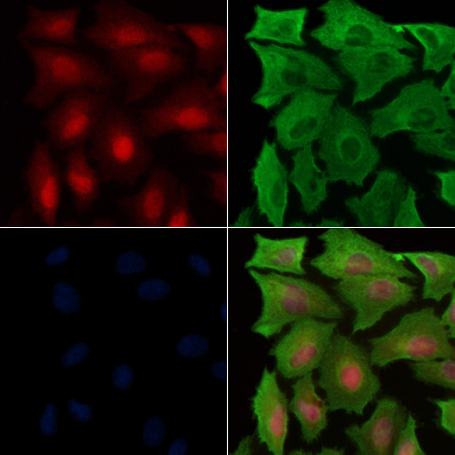 Phospho-Parkin (Ser65) Antibody in Immunocytochemistry (ICC/IF)