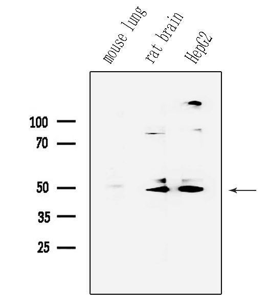 Phospho-Parkin (Ser65) Antibody in Western Blot (WB)