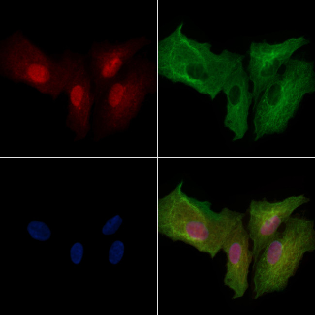 Phospho-PFKFB3 (Ser461) Antibody in Immunocytochemistry (ICC/IF)