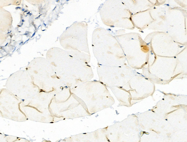 Phospho-PFKFB3 (Ser461) Antibody in Immunohistochemistry (Paraffin) (IHC (P))