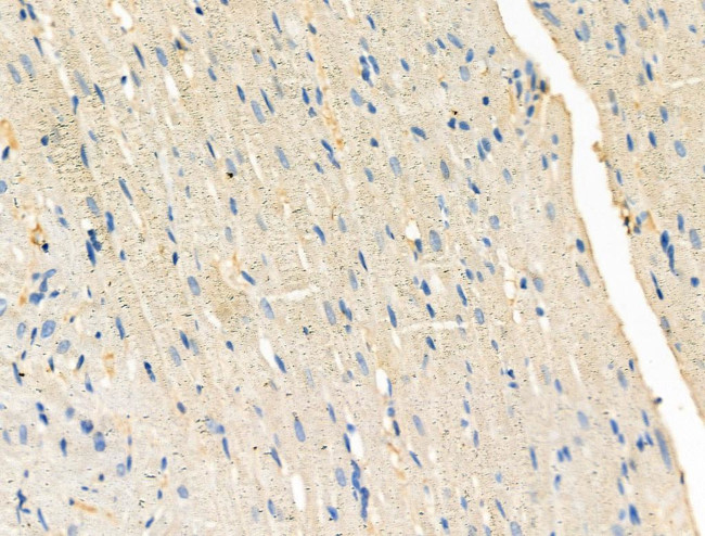 Phospho-PFKFB3 (Ser461) Antibody in Immunohistochemistry (Paraffin) (IHC (P))