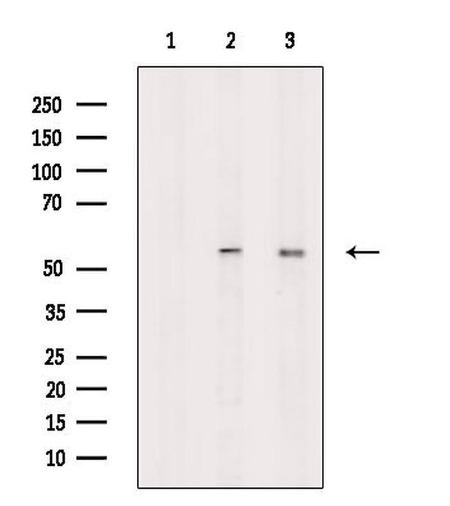 Phospho-PFKFB3 (Ser461) Antibody in Western Blot (WB)