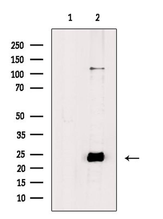 Phospho-Phospholamban (Ser714) Antibody in Western Blot (WB)