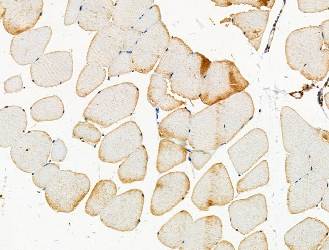 Phospho-PKC mu (Ser205) Antibody in Immunohistochemistry (Paraffin) (IHC (P))