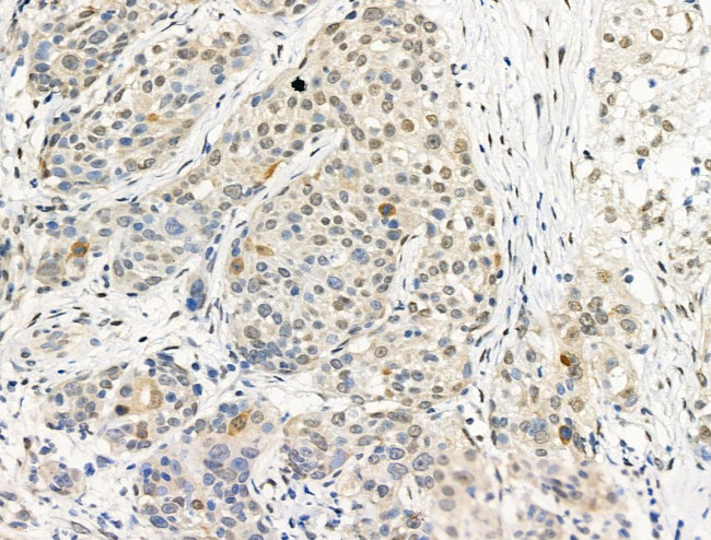 Phospho-PP1 alpha (Thr320) Antibody in Immunohistochemistry (Paraffin) (IHC (P))