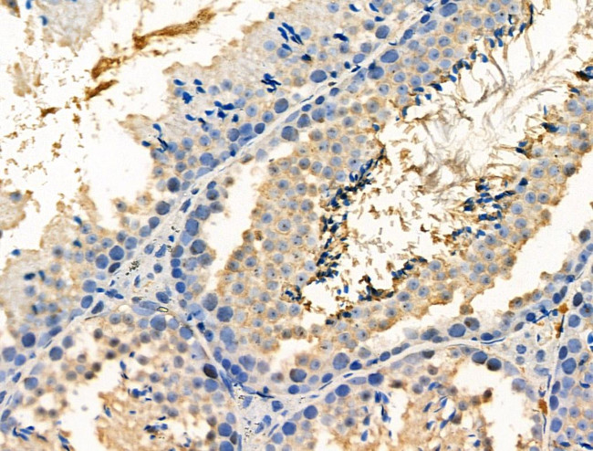 Phospho-PP1 alpha (Thr320) Antibody in Immunohistochemistry (Paraffin) (IHC (P))