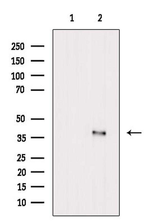 Phospho-PP1 alpha (Thr320) Antibody in Western Blot (WB)