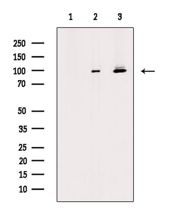 Phospho-Progesterone Receptor (Ser190) Antibody in Western Blot (WB)