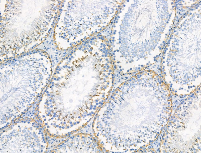 Phospho-PSD-95 (Ser418) Antibody in Immunohistochemistry (Paraffin) (IHC (P))