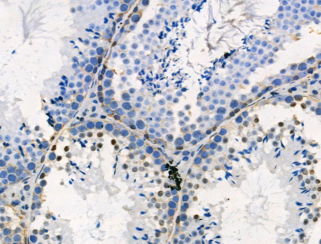 Phospho-PSD-95 (Ser418) Antibody in Immunohistochemistry (Paraffin) (IHC (P))