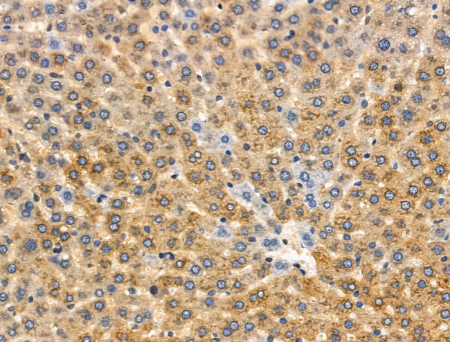 Phospho-PYGL (Ser15) Antibody in Immunohistochemistry (Paraffin) (IHC (P))