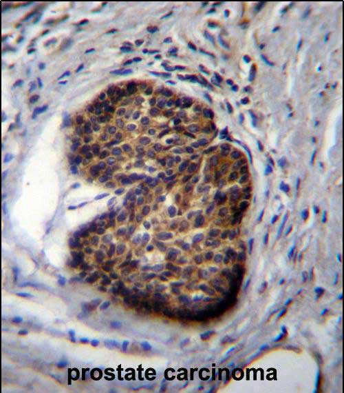 PSCA Antibody in Immunohistochemistry (Paraffin) (IHC (P))