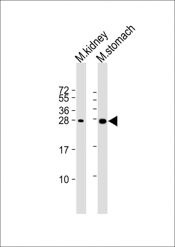 PSCA Antibody in Western Blot (WB)