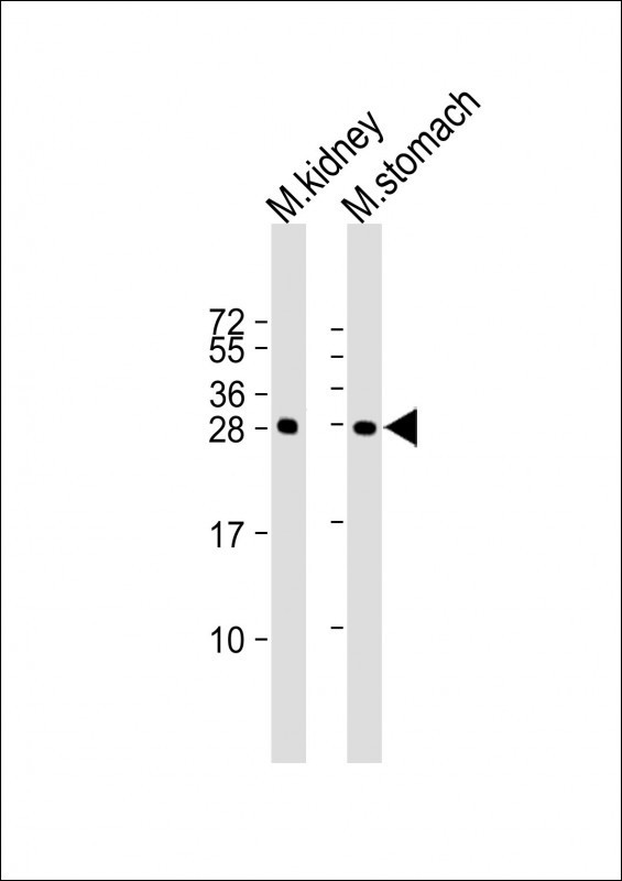 PSCA Antibody in Western Blot (WB)