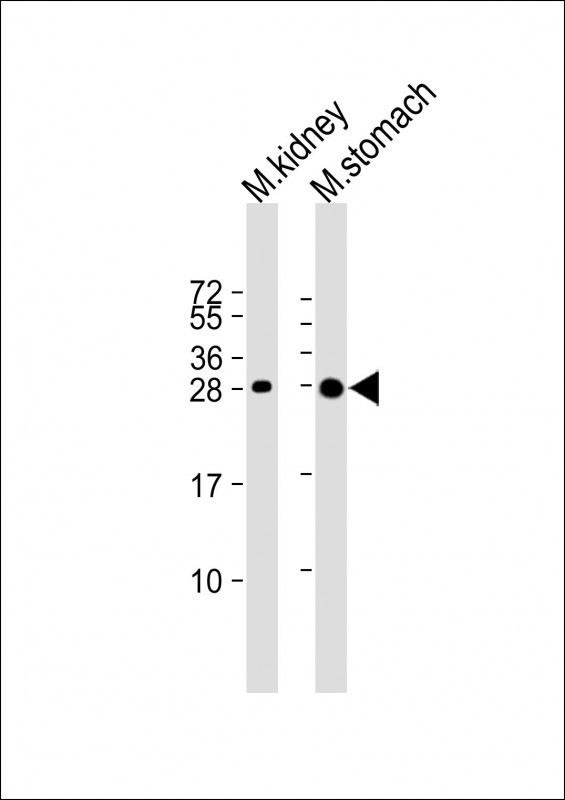 PSCA Antibody in Western Blot (WB)