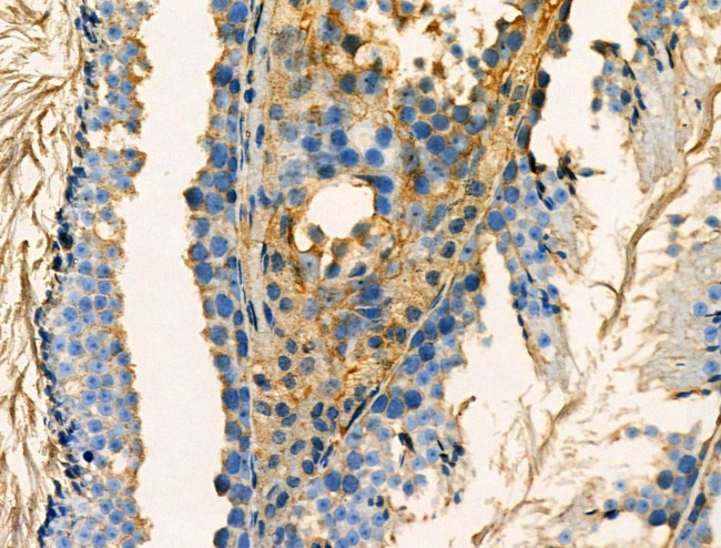 Phospho-RAB29 (Ser72) Antibody in Immunohistochemistry (Paraffin) (IHC (P))