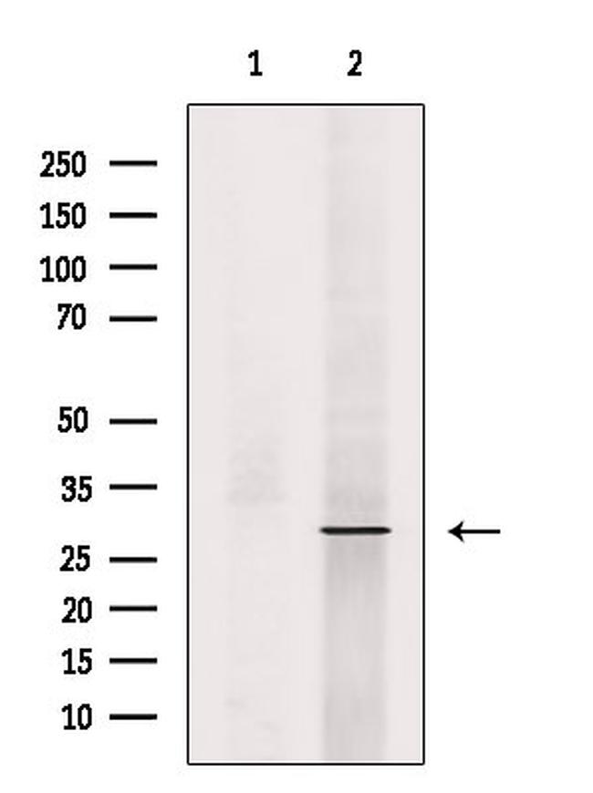 Phospho-RAB29 (Ser72) Antibody in Western Blot (WB)