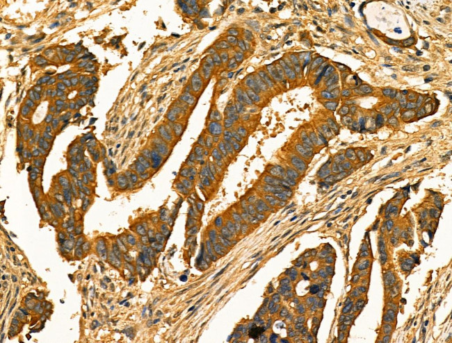 Phospho-RAB29 (Thr71) Antibody in Immunohistochemistry (Paraffin) (IHC (P))